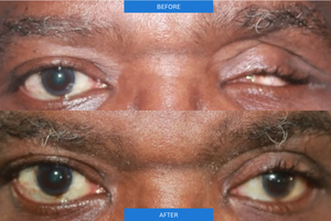 Before and After