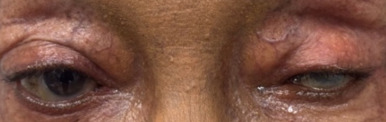 Before